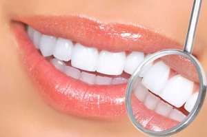 牙周炎：不容忽视的口腔健康问题