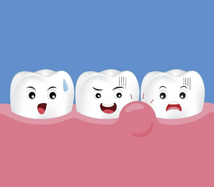 牙齿松动是什么原因造成的?应该如何解决呢?