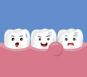 牙齿松动是什么原因造成的?应该如何解决呢?
