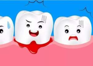 牙龈出血需要看医生吗？