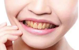 牙齿敏感：原因、预防与缓解之道