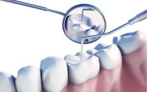 塞牙对牙齿的危害有哪些?