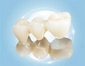 乳牙滞留的常见原因是什么？