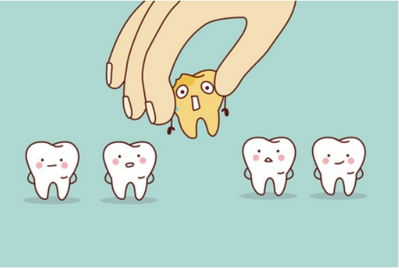 拔牙后多久能种植牙？种植牙需要多少钱？