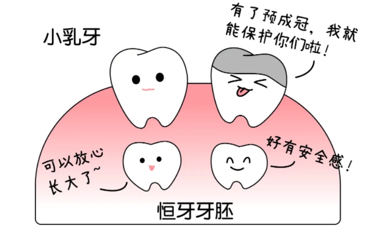 儿童预成冠有哪些好处？费用贵不贵？