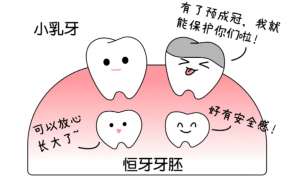 儿童预成冠有哪些好处？费用贵不贵？