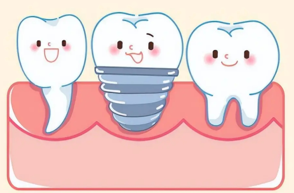 种植牙后期怎样护理呢？